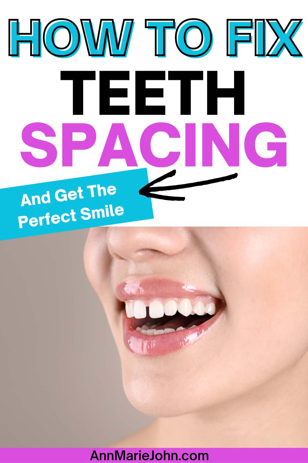 How to Fix Teeth Spacing